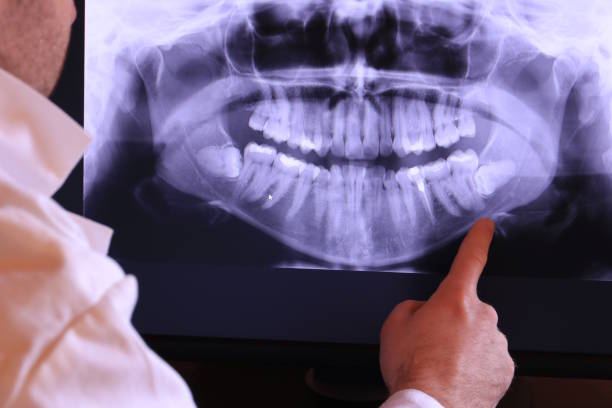Best Emergency Dentist for Knocked-Out Tooth in Wallis, TX