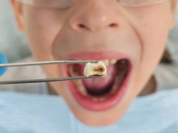 Best Emergency Dental Services for Seniors in Wallis, TX